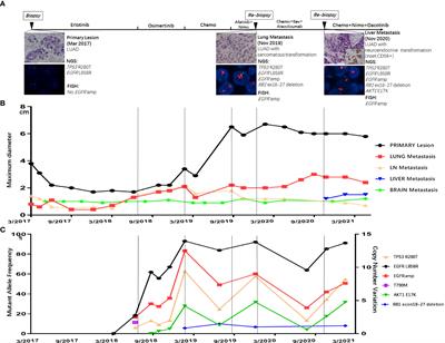 Heterogeneity of resistant mechanisms in an EGFR-TKI relapsed patient with EGFR amplification and response to nimotuzumab: A case report